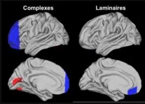 IRM cerveau des enfants HPI processus d'apprentissage et de réflexion.